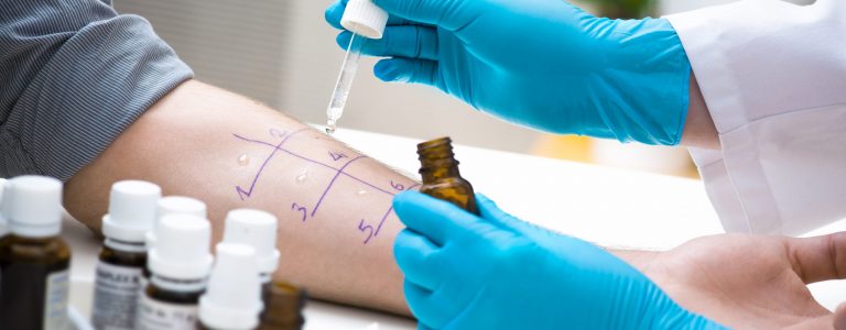Skin prick allergy to find out kind of allergy